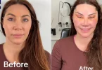 Lady’s facial transformation after six surgeries sparks mixed reactions