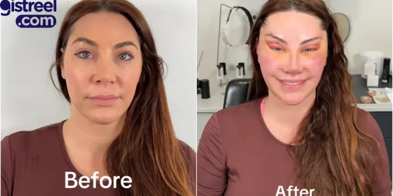 Lady’s facial transformation after six surgeries sparks mixed reactions