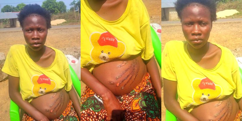 Pregnant woman wakes up with handprint on her belly after ‘spirit’ attack her in a dream