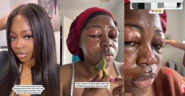 Lady shares how her eyelids began to swell after using eyelash extensions