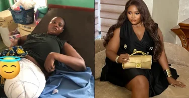 Lady celebrates one year of survival after losing leg to cancer