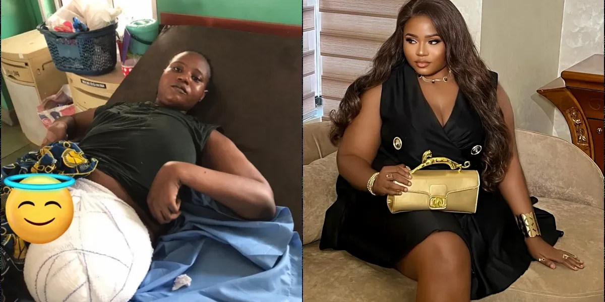 Lady celebrates one year of survival after losing leg to cancer
