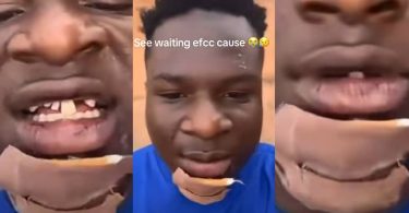 Man breaks jaw and loses teeth while trying to flee from EFCC operatives