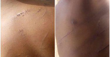 4-year-old orphan allegedly brutalized by his uncle for dancing at naming ceremony in Nasarawa