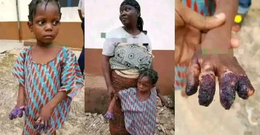 Grandmother arrested for burning granddaughter’s hands after she ate Indomie