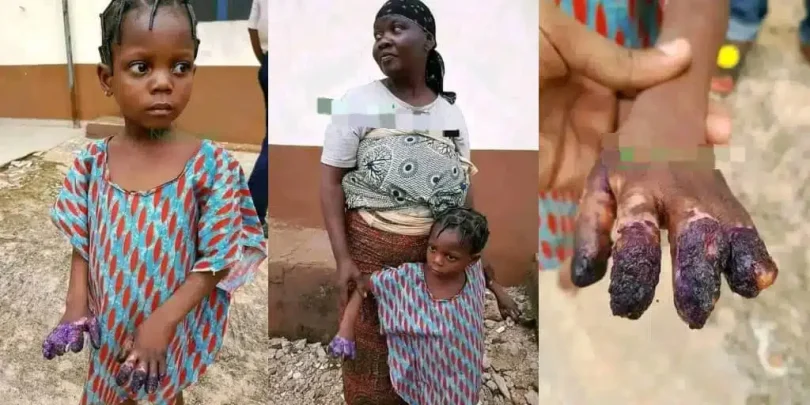 Grandmother arrested for burning granddaughter’s hands after she ate Indomie