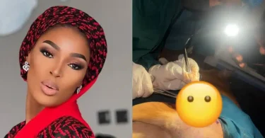 Assistant surgeon uses phone torchlight during surgery after blackout