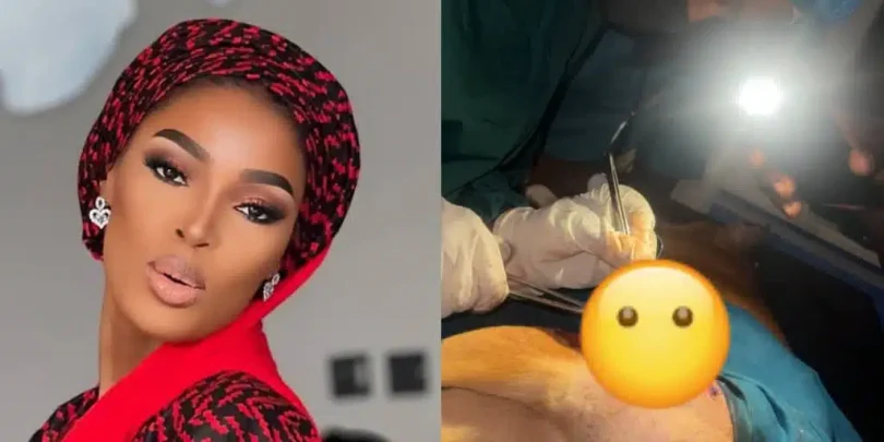 Assistant surgeon uses phone torchlight during surgery after blackout