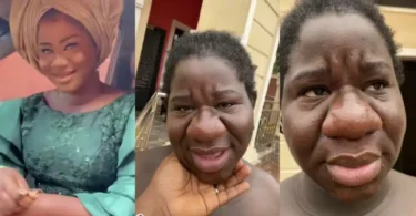 Lady shares her surprising pregnancy transformation