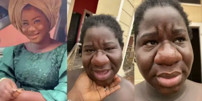 Lady shares her surprising pregnancy transformation