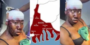 Lady stabbed in the head by fiancé after disagreement in Port Harcourt
