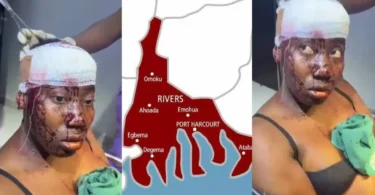 Lady stabbed in the head by fiancé after disagreement in Port Harcourt